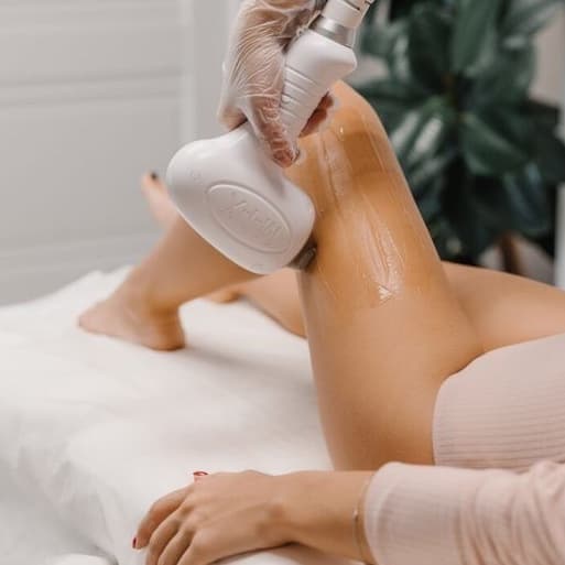 Laser Hair Removal Membership at YubyRo in San Juan, PR